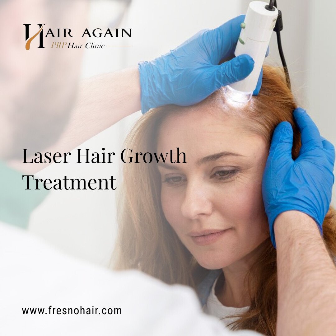 laser hair growth treatment Fresno