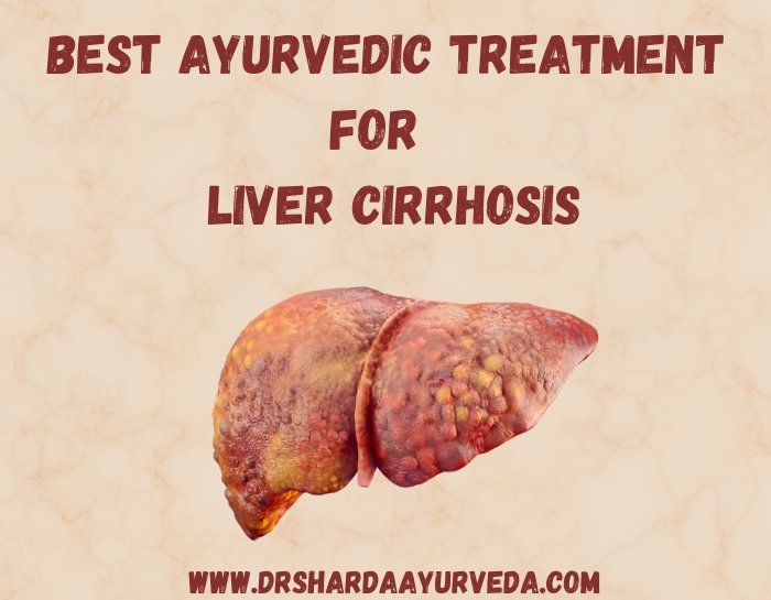 Ayurvedic Treatment For Liver Cirrhosis | Dr Sharda Ayurveda