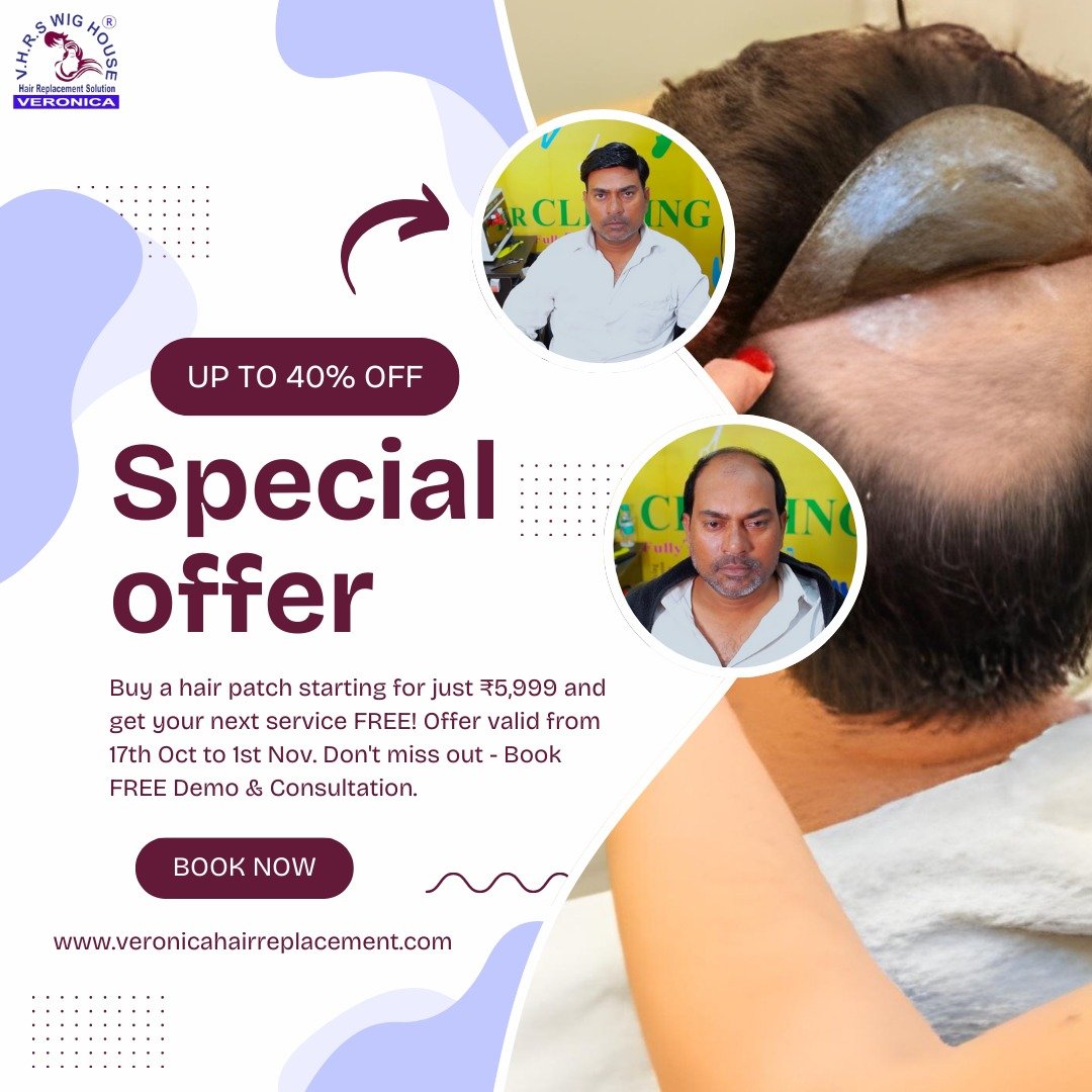 Non-Surgical Hair Replacement & Baldness Solutions in Delhi