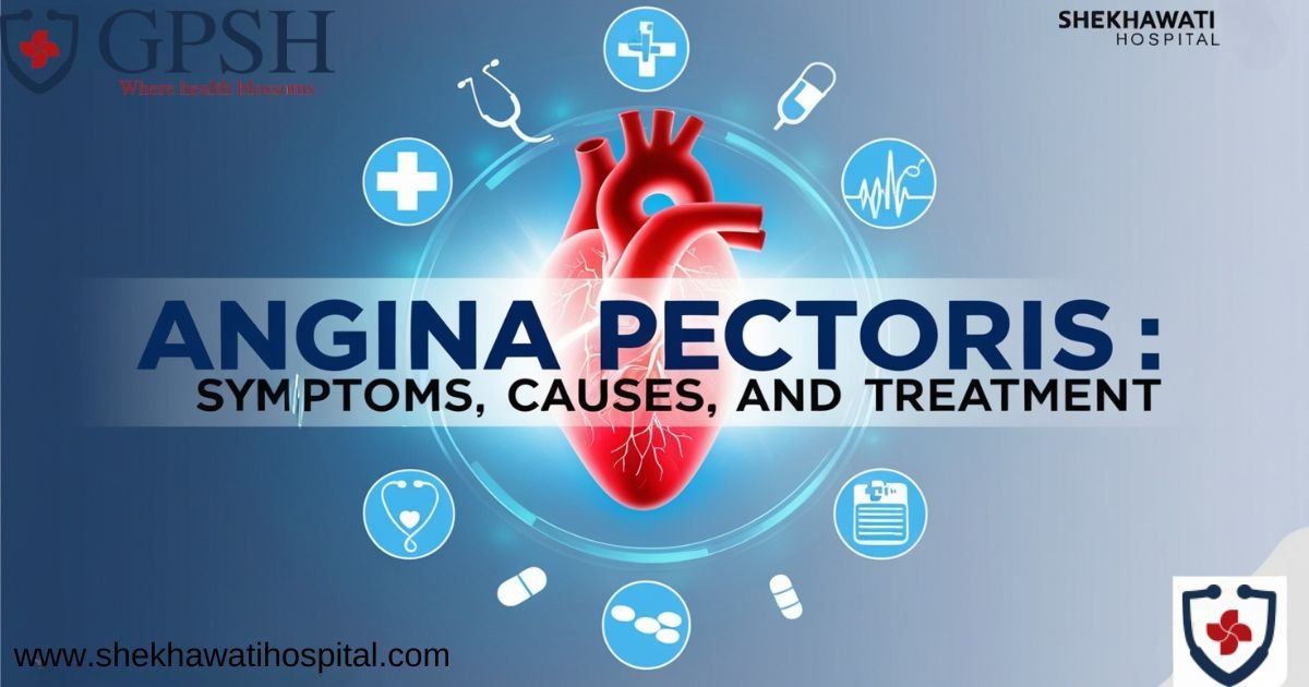 Angina Pectoris: Symptoms, Causes, and Treatment