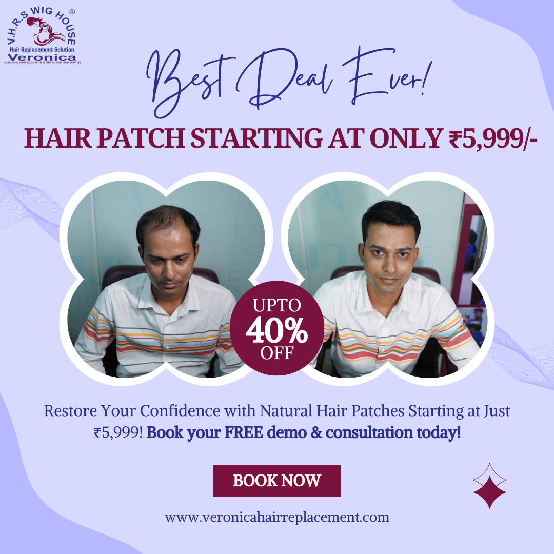 Best Hair Patch & Wigs fixing in Gurgaon | Veronica Hair Replacement Solution