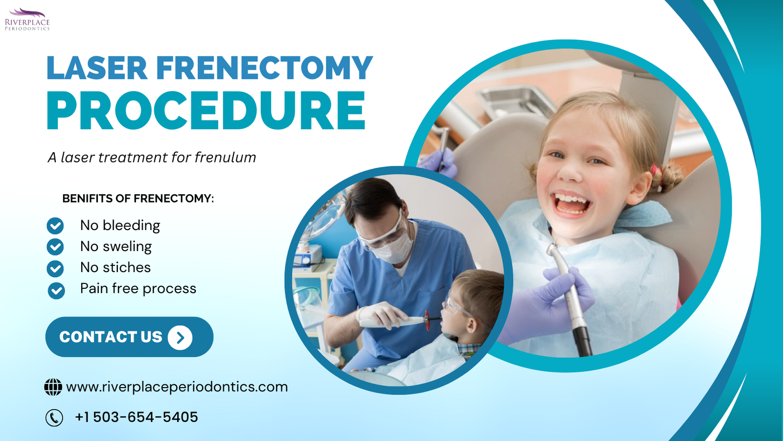 What is a Frenectomy Treatment ? Can Frenectomy Improve Your Smile ?