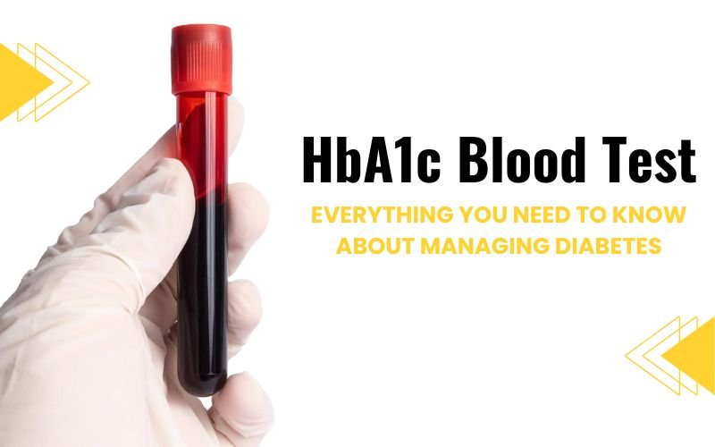 What is the HbA1c Blood Test? Everything You Need to Know About Managing Diabetes