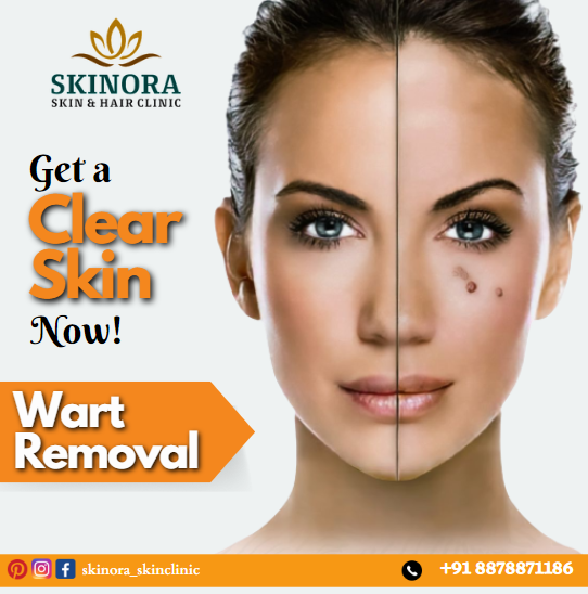 Skin brightening treatment in hyderabad