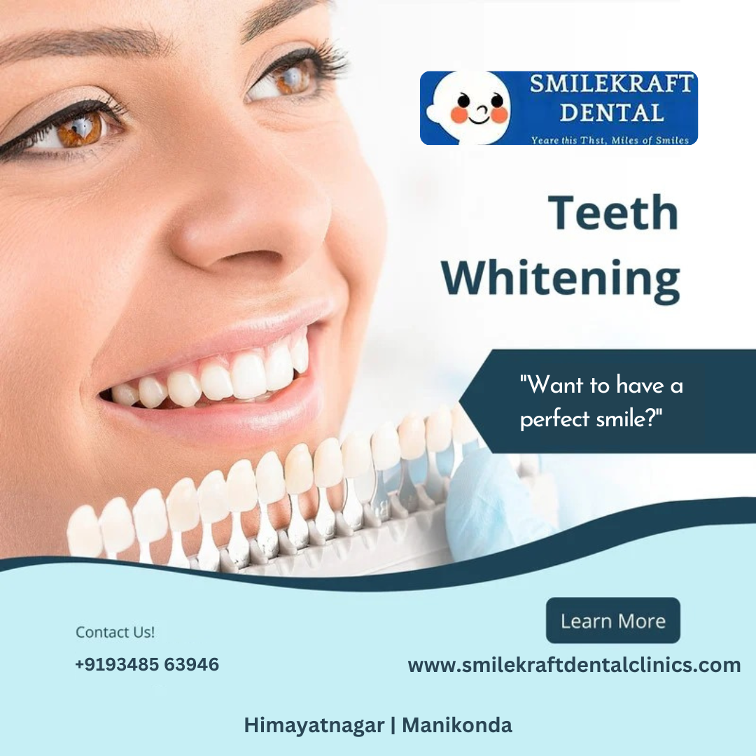 Achieve a Brighter Smile with Professional Teeth Whitening