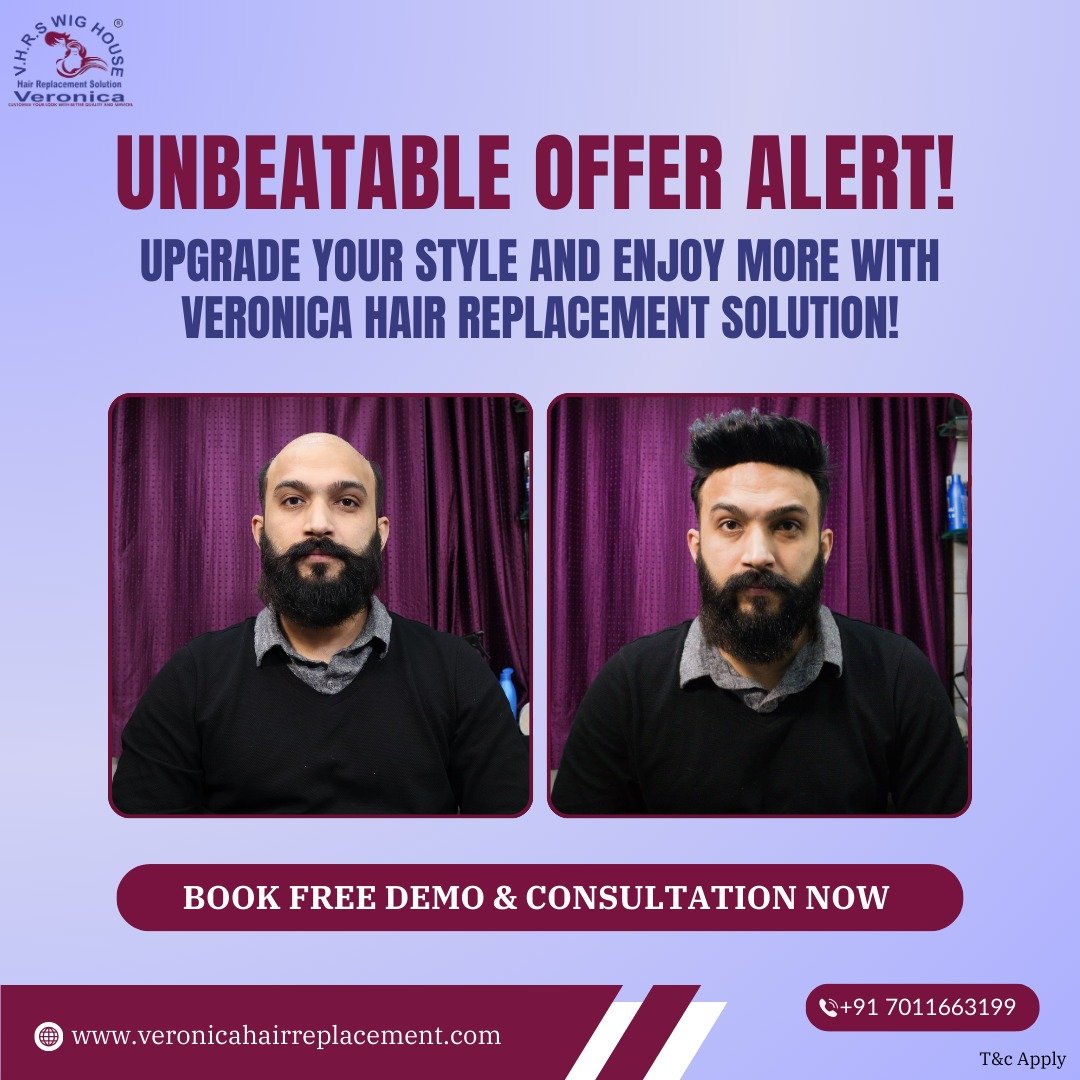 Premier Hair Replacement Solutions in Delhi: Transform Your Appearance Right Now