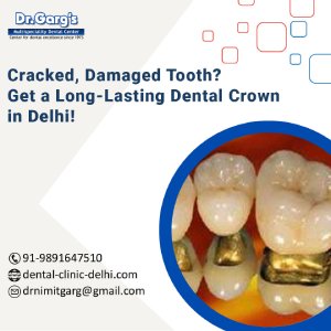 Cracked, Damaged Tooth? Get a Long-Lasting Dental Crown in Delhi! 