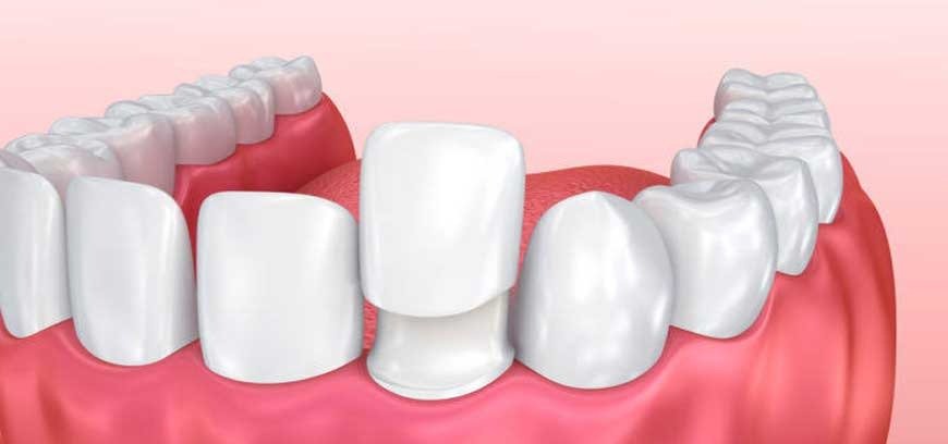 Best Dental Clinic in Coimbatore With Top Dental Treatments