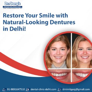 Restore Your Smile with Natural-Looking Dentures in Delhi!