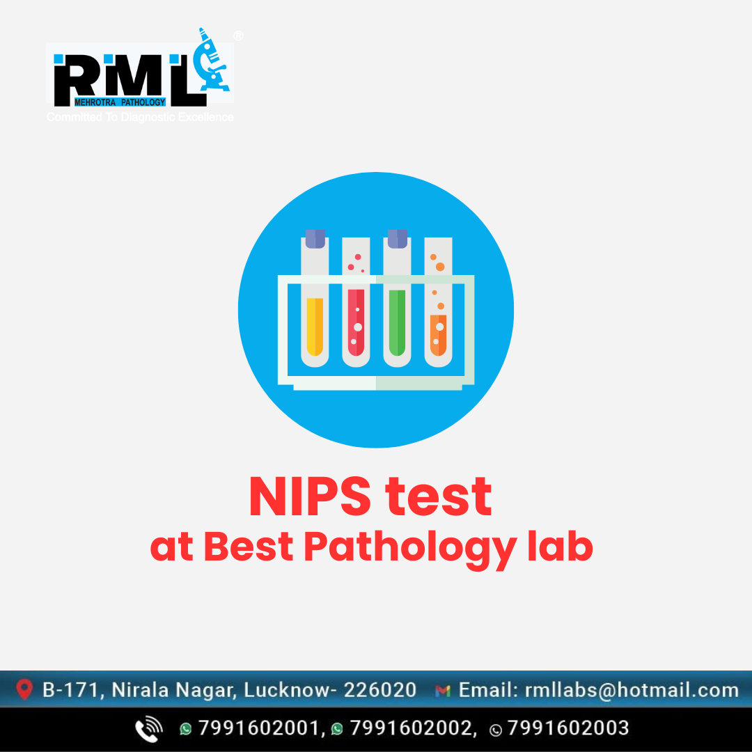 NIPS test in Lucknow at best price