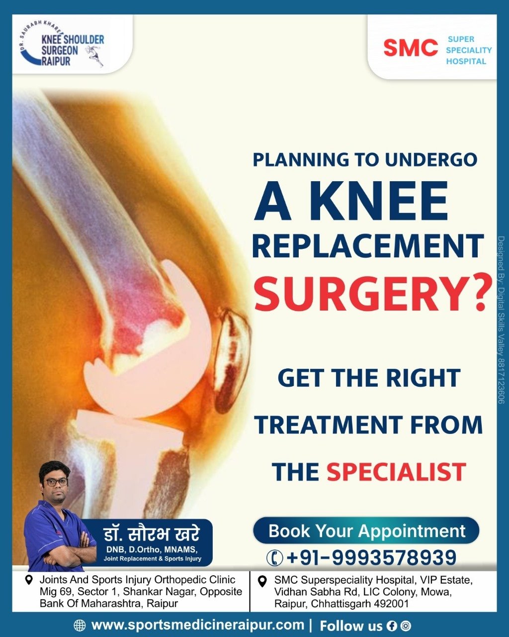 Best Knee Replacement Surgeon in Raipur – Dr. Saurabh Khare