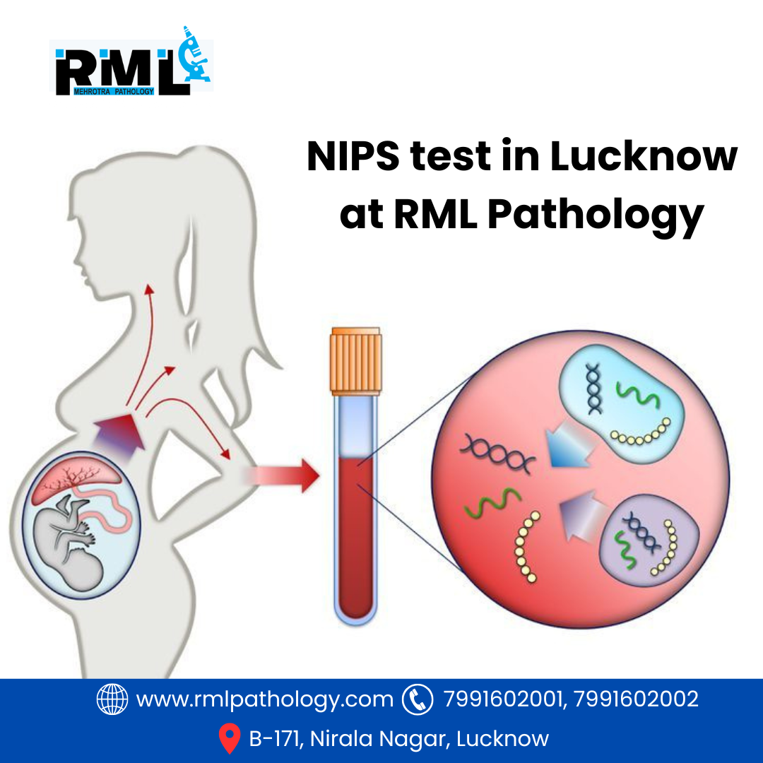 Non-invasive prenatal screening test (NIPS Test) in Lucknow